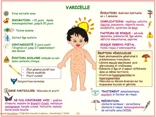 comment soulager varicelle
